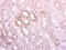 Ribophorin I antibody, PA5-27562, Invitrogen Antibodies, Immunohistochemistry paraffin image 