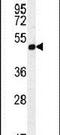 Alpha 1,4-Galactosyltransferase (P Blood Group) antibody, PA5-23625, Invitrogen Antibodies, Western Blot image 