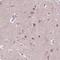 Immunoglobulin Superfamily Containing Leucine Rich Repeat 2 antibody, PA5-64324, Invitrogen Antibodies, Immunohistochemistry frozen image 