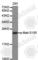 BCL2 Associated Agonist Of Cell Death antibody, AP0312, ABclonal Technology, Western Blot image 