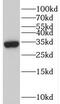 Tumor Suppressing Subtransferable Candidate 4 antibody, FNab09072, FineTest, Western Blot image 