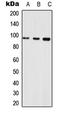 Neuroligin 1 antibody, LS-C354442, Lifespan Biosciences, Western Blot image 