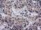 DnaJ Heat Shock Protein Family (Hsp40) Member B1 antibody, M03100, Boster Biological Technology, Immunohistochemistry paraffin image 