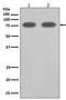Scavenger Receptor Class B Member 1 antibody, M01093, Boster Biological Technology, Western Blot image 