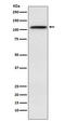 Exportin 1 antibody, M01180-1, Boster Biological Technology, Western Blot image 