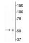 Gamma-Aminobutyric Acid Type A Receptor Beta1 Subunit antibody, NB300-197, Novus Biologicals, Western Blot image 