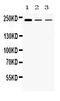 Tectorin Alpha antibody, A02840, Boster Biological Technology, Western Blot image 