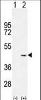 Cochlin antibody, LS-C166909, Lifespan Biosciences, Western Blot image 