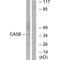 Carbonic Anhydrase 5B antibody, A11974, Boster Biological Technology, Western Blot image 