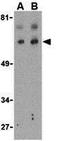 BCL2 Like 13 antibody, GTX31276, GeneTex, Western Blot image 