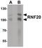 Ring Finger Protein 20 antibody, PA5-34552, Invitrogen Antibodies, Western Blot image 