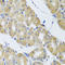 Synaptosome Associated Protein 29 antibody, A05318, Boster Biological Technology, Immunohistochemistry paraffin image 