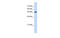 Ubiquitin Protein Ligase E3 Component N-Recognin 7 (Putative) antibody, MBS5301686, MyBioSource, Western Blot image 