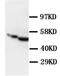 GFAP antibody, AP23244PU-N, Origene, Western Blot image 