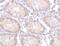 Protein Tyrosine Kinase 7 (Inactive) antibody, AHP1440, Bio-Rad (formerly AbD Serotec) , Immunohistochemistry paraffin image 