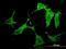 P21 (RAC1) Activated Kinase 3 antibody, H00005063-M07, Novus Biologicals, Immunocytochemistry image 