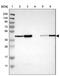 Thioredoxin Related Transmembrane Protein 4 antibody, PA5-53379, Invitrogen Antibodies, Western Blot image 