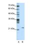 Mitochondrial RRNA Methyltransferase 1 antibody, NBP1-57367, Novus Biologicals, Western Blot image 