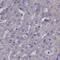 IKBKB Interacting Protein antibody, PA5-65219, Invitrogen Antibodies, Immunohistochemistry paraffin image 