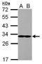 Eukaryotic Translation Initiation Factor 2B Subunit Alpha antibody, NBP2-16292, Novus Biologicals, Western Blot image 