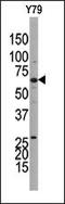 Guanylate cyclase soluble subunit beta-1 antibody, LS-C100952, Lifespan Biosciences, Western Blot image 