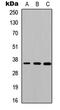 Cathepsin K antibody, LS-C354307, Lifespan Biosciences, Western Blot image 