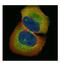 Transforming growth factor beta-1-induced transcript 1 protein antibody, NBP2-16828, Novus Biologicals, Immunocytochemistry image 