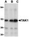 Mitogen-Activated Protein Kinase Kinase Kinase 7 antibody, MBS150969, MyBioSource, Western Blot image 