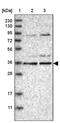 Kelch Domain Containing 3 antibody, PA5-56357, Invitrogen Antibodies, Western Blot image 