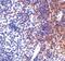 Interferon Regulatory Factor 7 antibody, PA5-20281, Invitrogen Antibodies, Immunohistochemistry paraffin image 