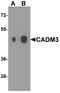 Cell Adhesion Molecule 3 antibody, A08747, Boster Biological Technology, Western Blot image 