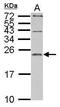 Interleukin 1 Receptor Antagonist antibody, PA5-21776, Invitrogen Antibodies, Western Blot image 