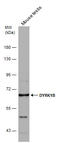 Dual Specificity Tyrosine Phosphorylation Regulated Kinase 1B antibody, GTX111575, GeneTex, Western Blot image 