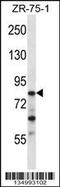 CCR4-NOT transcription complex subunit 3 antibody, 57-967, ProSci, Western Blot image 