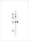 SS Nuclear Autoantigen 1 antibody, LS-C203962, Lifespan Biosciences, Western Blot image 