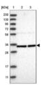 Zinc Finger Protein 124 antibody, NBP1-81634, Novus Biologicals, Western Blot image 