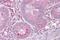 Solute Carrier Family 13 Member 2 antibody, A07831, Boster Biological Technology, Immunohistochemistry paraffin image 
