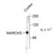 Myristoylated Alanine Rich Protein Kinase C Substrate antibody, 50-108, ProSci, Western Blot image 