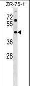 Zinc Finger And SCAN Domain Containing 31 antibody, LS-C157440, Lifespan Biosciences, Western Blot image 