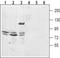 Two Pore Segment Channel 2 antibody, TA328756, Origene, Western Blot image 