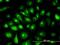 Keratin 81 antibody, orb89634, Biorbyt, Immunocytochemistry image 