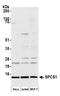 Signal Peptidase Complex Subunit 1 antibody, A305-823A-M, Bethyl Labs, Western Blot image 