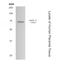 Matrix Metallopeptidase 15 antibody, GTX52481, GeneTex, Western Blot image 