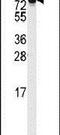 DLG Associated Protein 5 antibody, PA5-12415, Invitrogen Antibodies, Western Blot image 