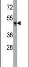 Histone Acetyltransferase 1 antibody, PA5-11214, Invitrogen Antibodies, Western Blot image 