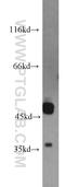 RING finger protein unkempt-like antibody, 15000-1-AP, Proteintech Group, Western Blot image 