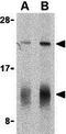 Interleukin 32 antibody, GTX85070, GeneTex, Western Blot image 