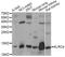 Killer Cell Lectin Like Receptor C4 antibody, A14807, ABclonal Technology, Western Blot image 
