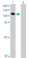 Collagen Type XXI Alpha 1 Chain antibody, H00081578-B01P, Novus Biologicals, Western Blot image 