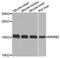 Methionine Sulfoxide Reductase B2 antibody, STJ110662, St John